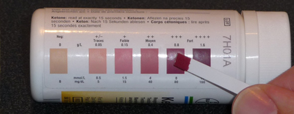 How To Check Ketones In Urine